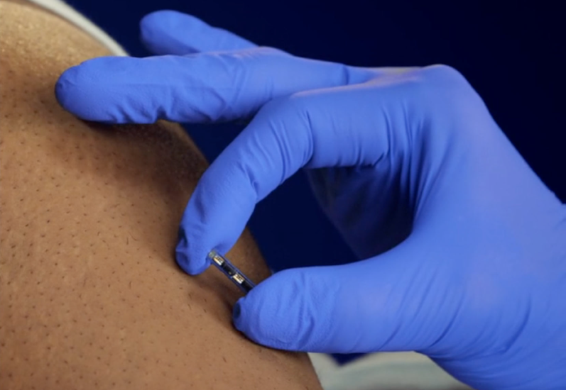 Close up on the Eversense long-term glucose monitoring sensor